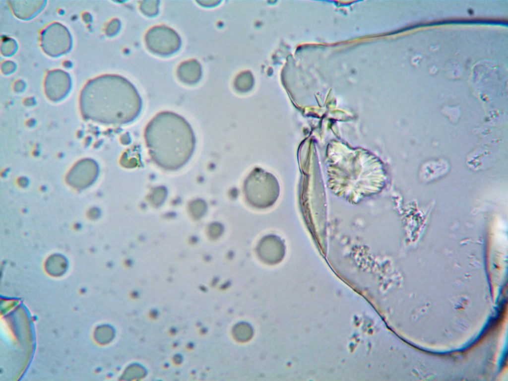 bacteria in microscopic view